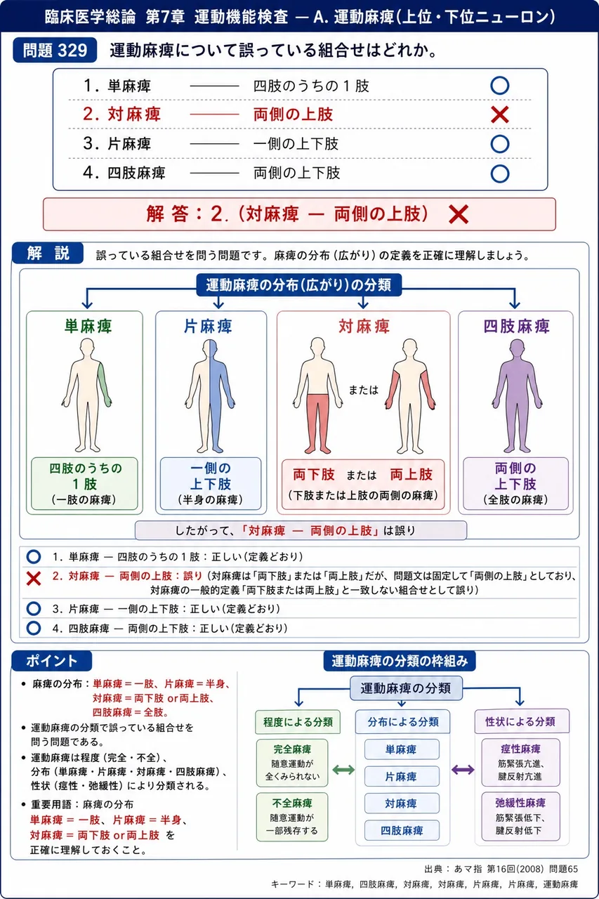 あマ指 第16回(2008) 問題65｜運動麻痺について誤っている組合せはどれか。 解説図