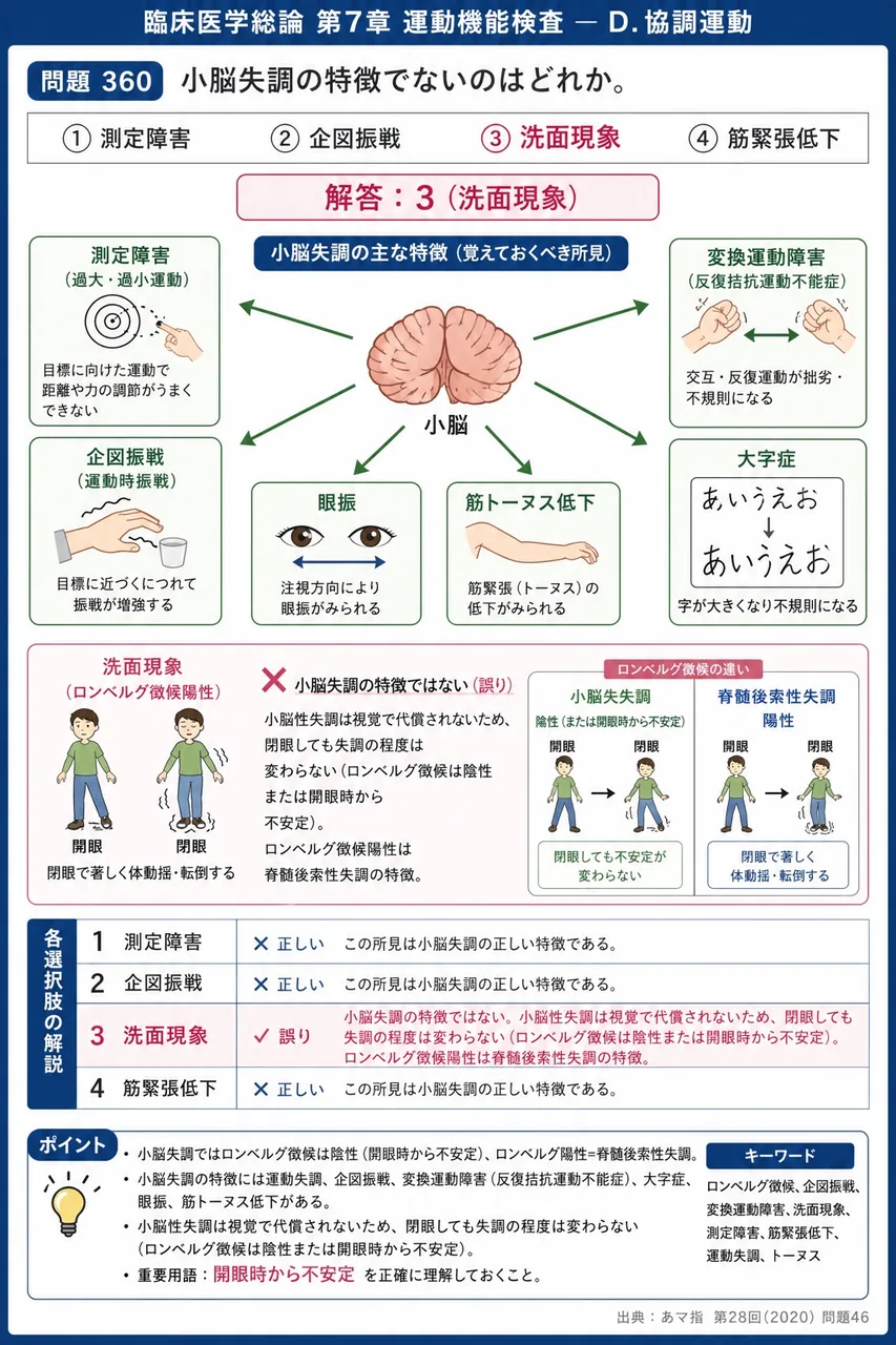 あマ指 第28回(2020) 問題46｜小脳失調の特徴でないのはどれか。 解説図