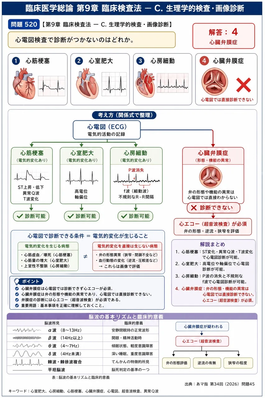 あマ指 第34回(2026) 問題45|心電図検査で診断がつかないのはどれか。 解説図