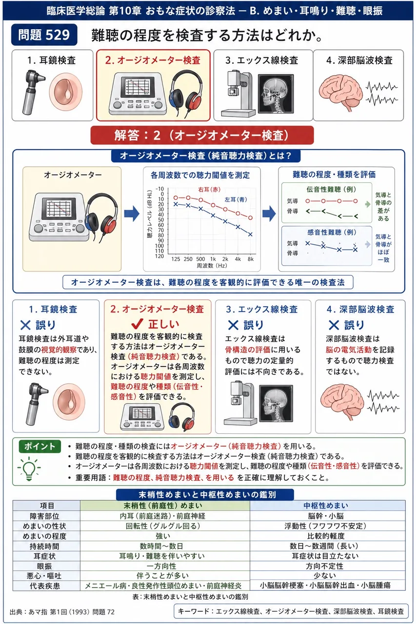 あマ指 第1回(1993) 問題72|難聴の程度を検査する方法はどれか。 解説図