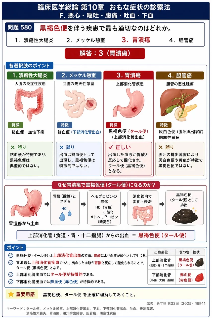 あマ指 第33回(2025) 問題41｜黒褐色便を伴う疾患で最も適切なのはどれか。 解説図