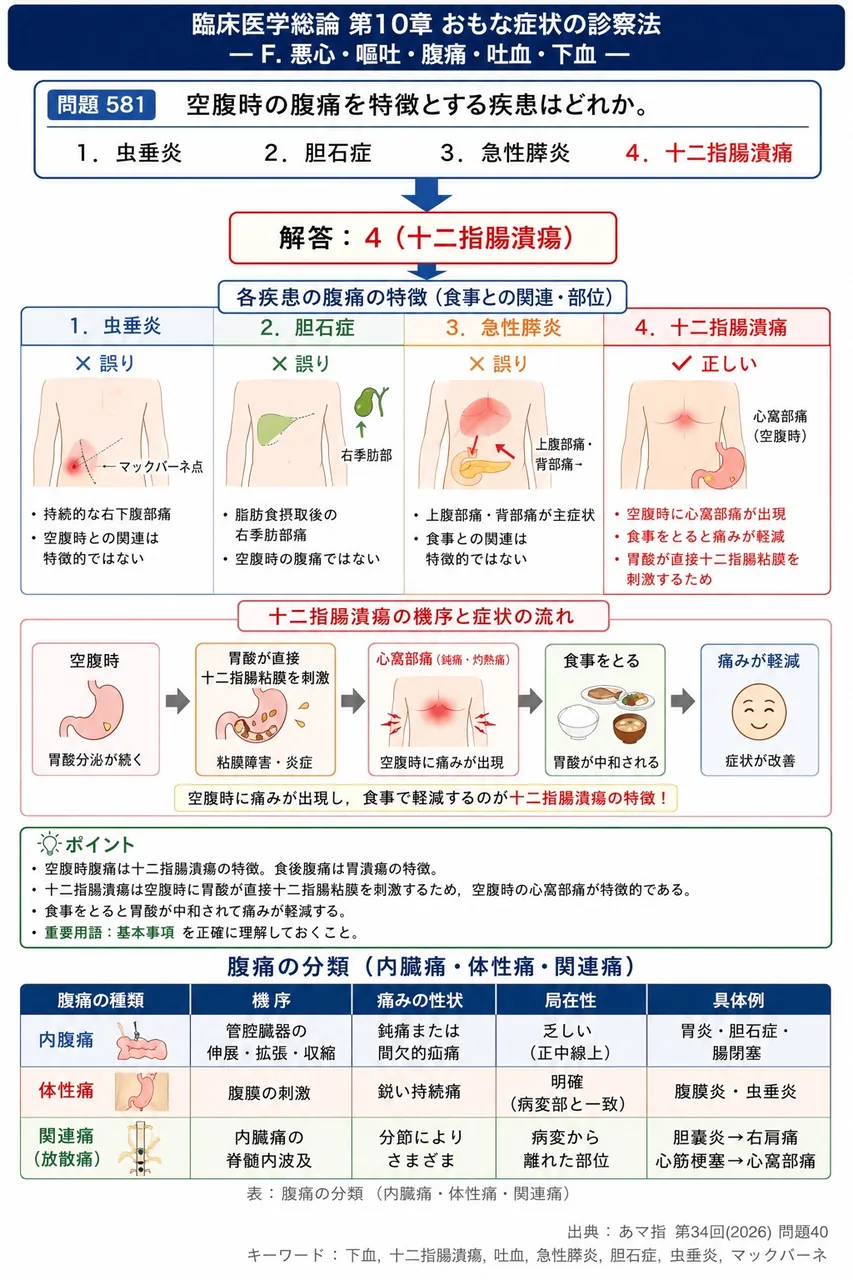 あマ指 第34回(2026) 問題40|空腹時の腹痛を特徴とする疾患はどれか。 解説図