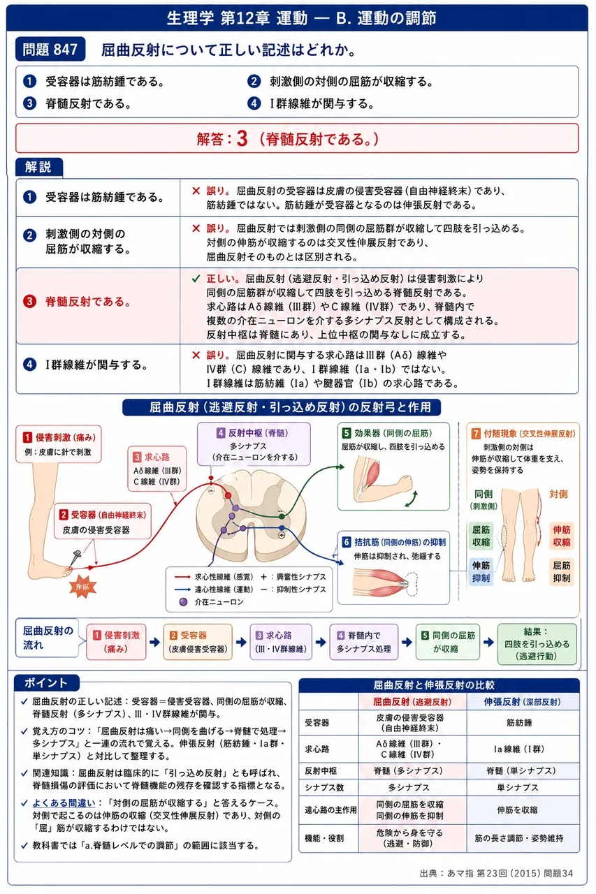 あマ指 第23回(2015) 問題34｜屈曲反射について正しい記述はどれか。 解説図