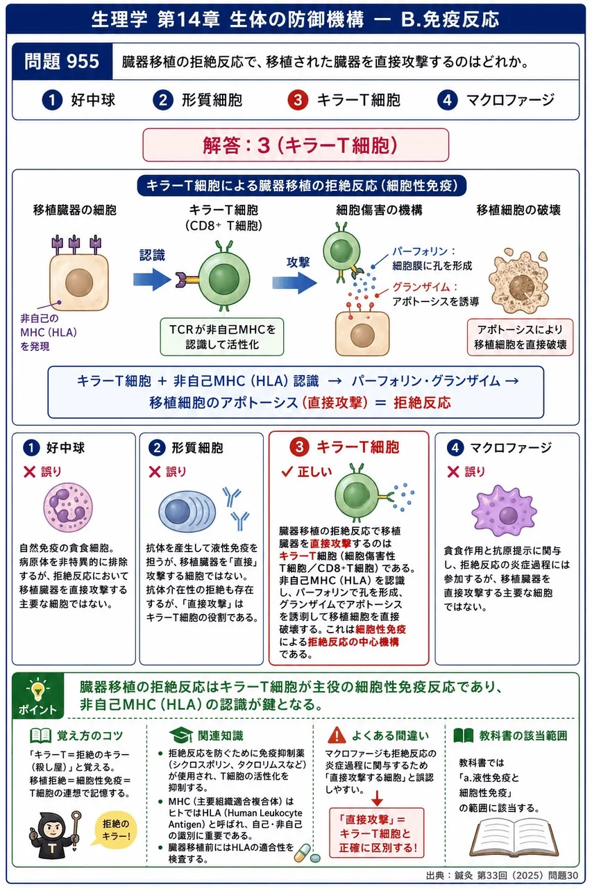 鍼灸 第33回(2025) 問題30｜臓器移植の拒絶反応で、移植された臓器を直接攻撃するのはどれか。 解説図